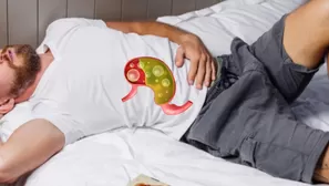 ¿Echarse a dormir luego de comer puede causar reflujo?