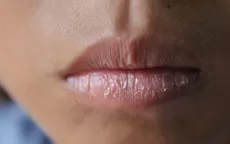¿Qué productos usar para reparar e hidratar tus labios resecos? - Noticias de marc-anthony