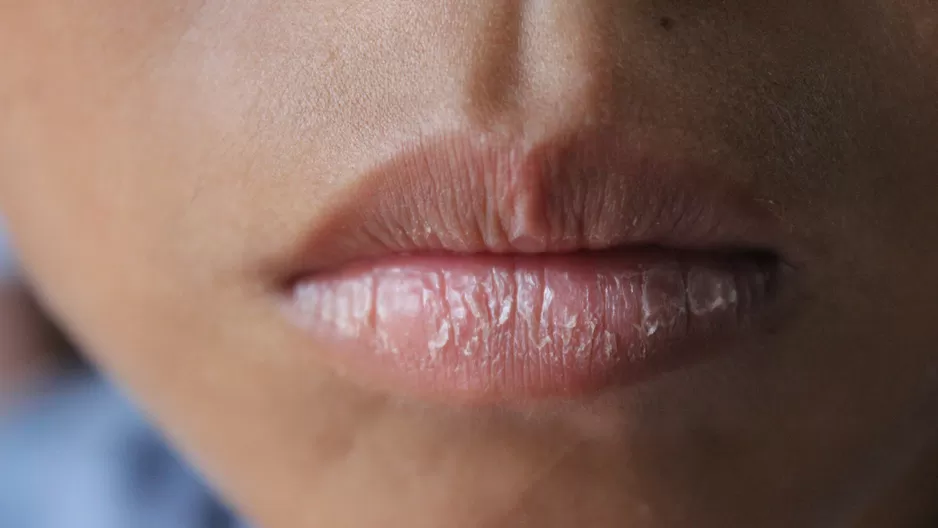 ¿Por qué se resecan tus labios?