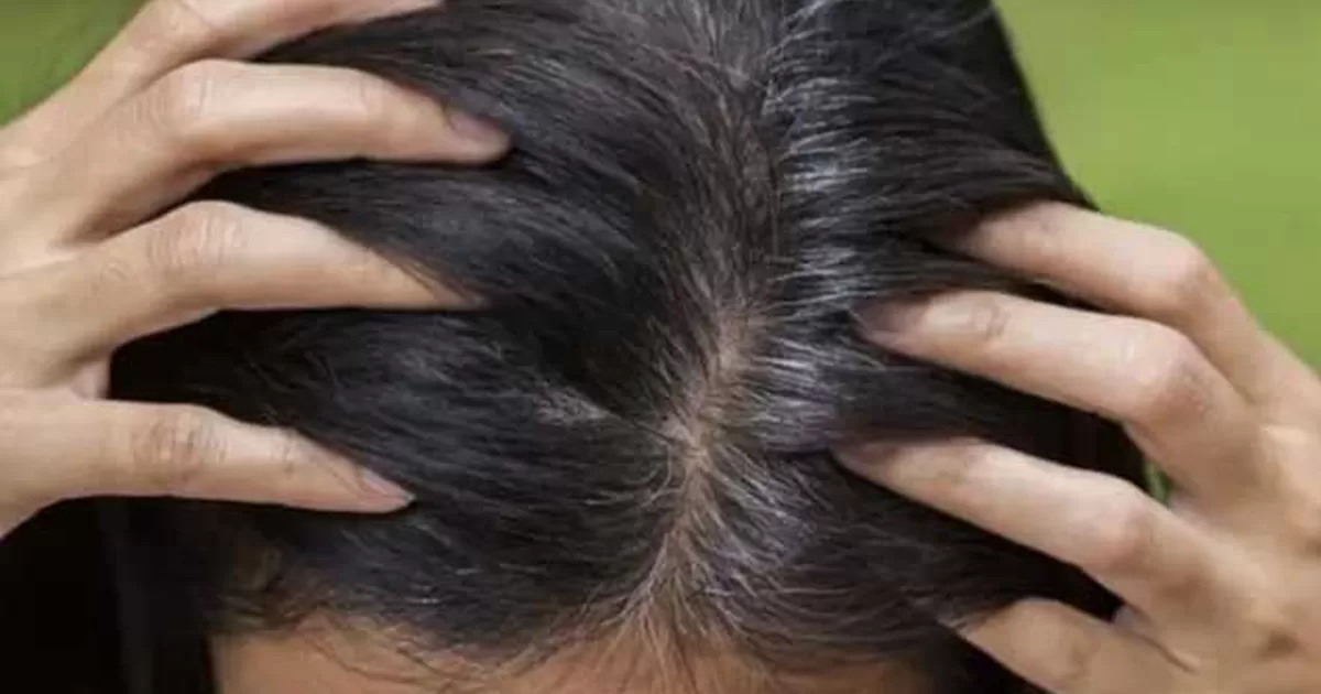 ¿Por qué salen canas a temprana edad? - America Noticias