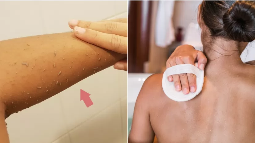¿Por qué salen “rollitos de mugre” en la piel cuando me baño?