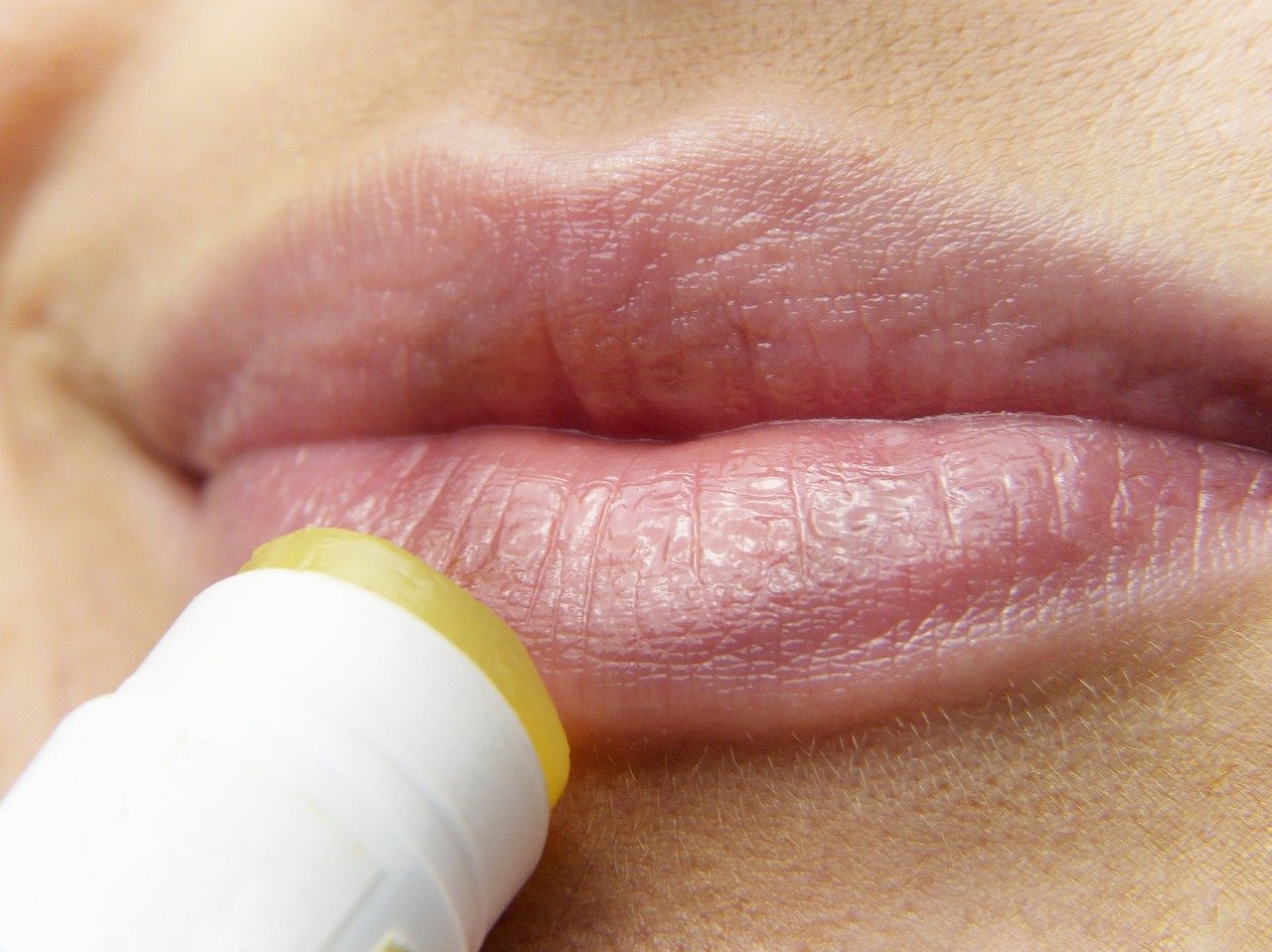 Las causas de los labios resecos