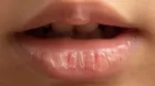 ¿Por qué se resecan tus labios y cómo mantenerlos hidratados?