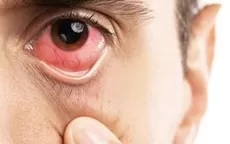 ¿Por qué sientes tus ojos secos y qué puede ocurrir si no los tratas? - Noticias de ministerio-salud
