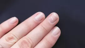 Si me pica la mano derecha, ¿significa que recibiré dinero?