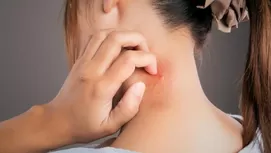 Tips para eliminar zancudos y cómo encontrarlos en tu cuarto