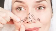 Conoce por qué te aparecen los puntos negros en tu rostro