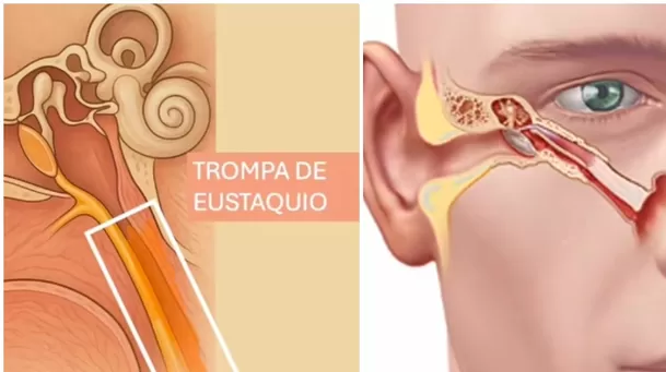 Ubicación de la trompa de Eustaquio en el oído medio. (Imagen: @perdiendoelmiedoavolar) Ubicación de la trompa de Eustaquio en el oído medio. (Imagen: @perdiendoelmiedoavolar)