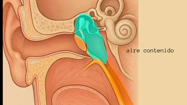 Aire contenido en el oído durante un vuelo. (Imagen: @perdiendoelmiedoavolar) Aire contenido en el oído durante un vuelo. (Imagen: @perdiendoelmiedoavolar)