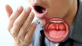 ¿Por qué tienes mal aliento pese a haberte cepillado los dientes?