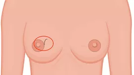 Cabello grueso y áspero: ¿por qué sale y como evitarlo?