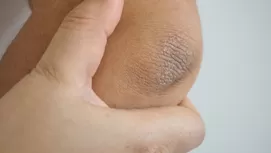 Vaselina: los increíbles usos recomendados por dermatóloga