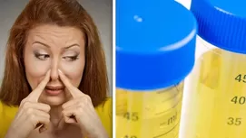 Cáncer de vejiga: síntomas a los que debes prestar atención