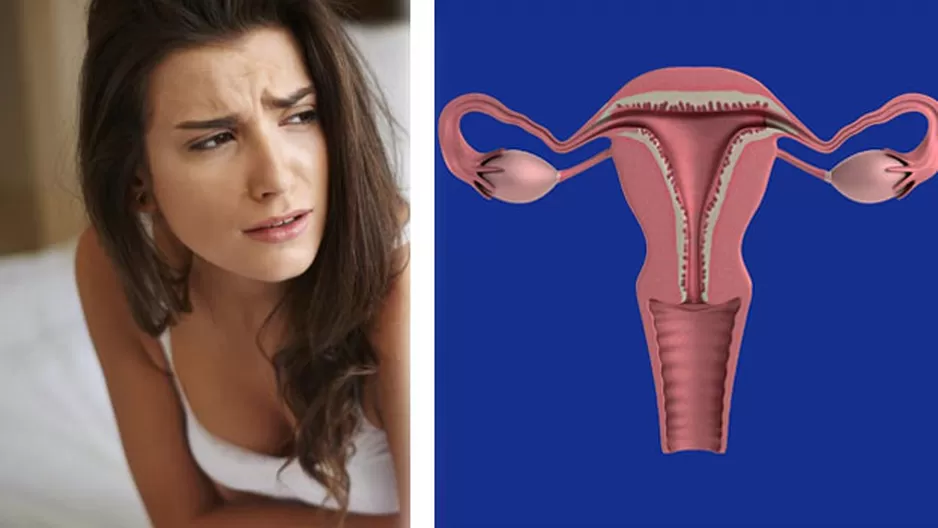 Causas del sangrado entre periodos menstruales