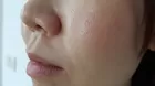 ¿Se pueden cerrar o hacer menos visibles los poros abiertos de la cara?