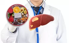 Si empiezo a comer saludable, ¿puedo revertir el hígado graso? - Noticias de Carmen Salinas
