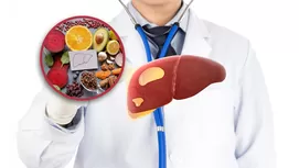 Hígado graso: ¿qué debes comer y qué no?