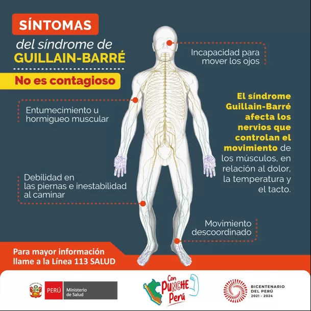 Síntomas del Síndrome de Guillain Barré, una enfermedad que no es contagiosa. (Foto: Minsa)