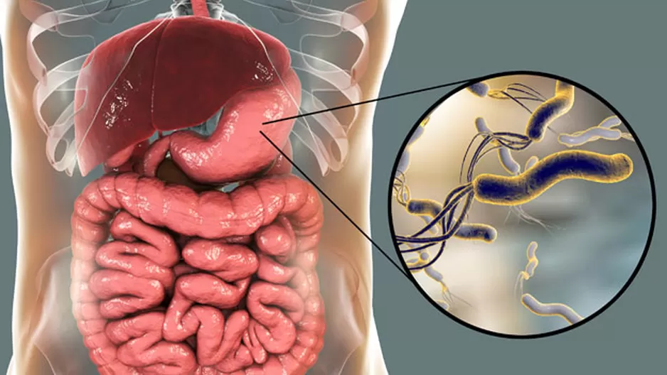 Conoce además cómo evitar el contagio de esta peligrosa bacteria