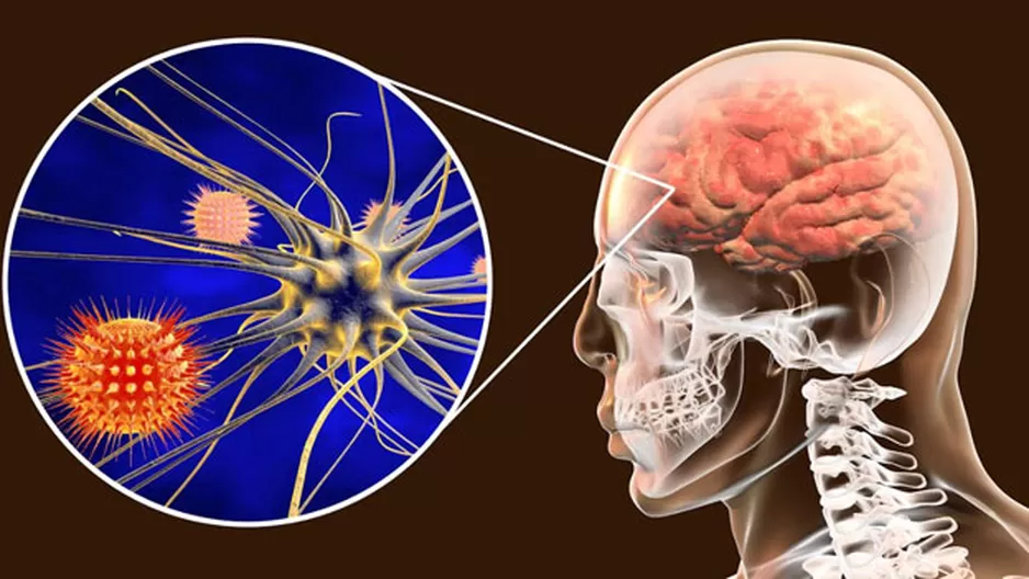 Este 24 de abril es el Día Mundial Contra la Meningitis