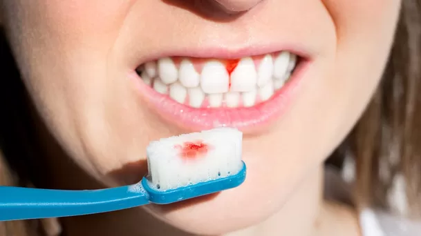 El significado de soñar con el ver sangre en tus dientes