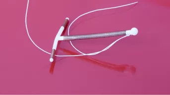 Una de las ventajas de la T de cobre es que es reversible en torno a la fertilidad