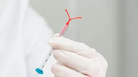 Implante anticonceptivo: ¿Cómo funciona y cuán efectivo es?