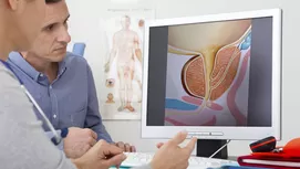 Cáncer de próstata: cómo descartarlo sin el examen de tacto rectal