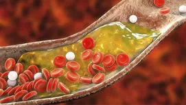 ¿Por qué tengo el colesterol alto si como sano?