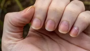 Las causas por las que las uñas lucen amarillas