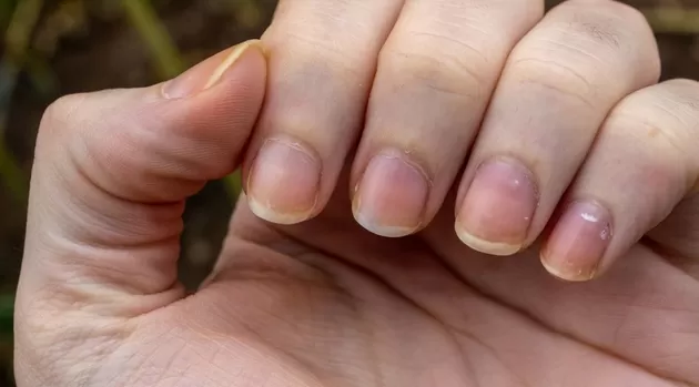 ¿Por qué tus uñas se tiñen de amarillo?